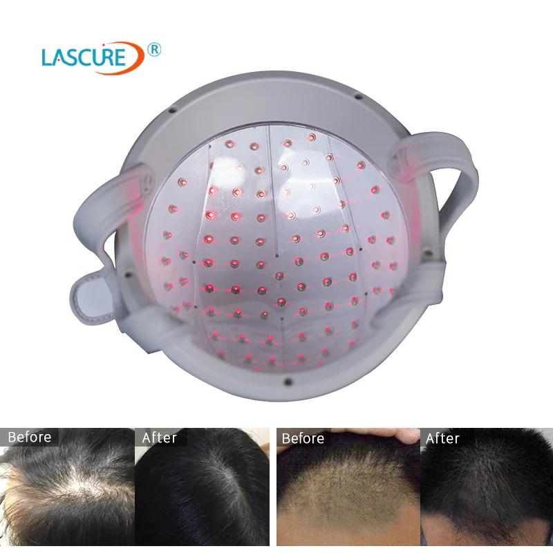 casaca laser pentru cresterea parului